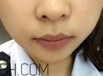 小蜜蜂細致修護唇膏很油嗎？夏天用合適嗎？