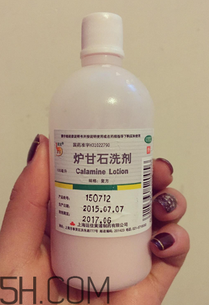 爐甘石洗劑多少錢一瓶？爐甘石洗劑治痤瘡嗎？