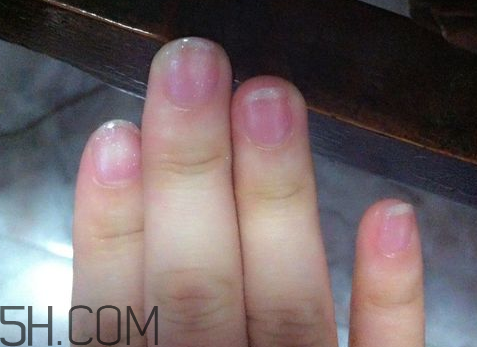 美甲后指甲受損怎么辦？指甲破損怎么修復？