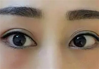 怎么紋美瞳線好看？紋美瞳線的危害