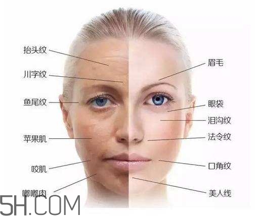 怎么預防皺紋的產生？導致皺紋的產生的原因有哪些？