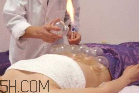 腹部拔罐可以減肥嗎？腹部拔罐拔哪個位置？
