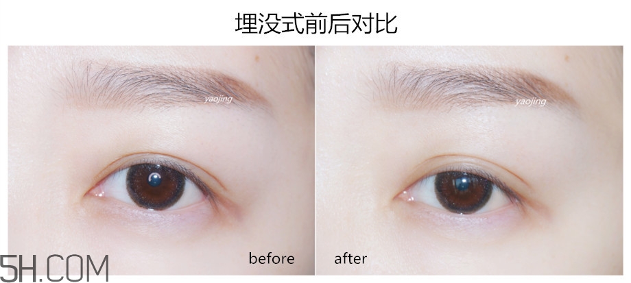 三種不同材質雙眼皮貼的正確貼法圖