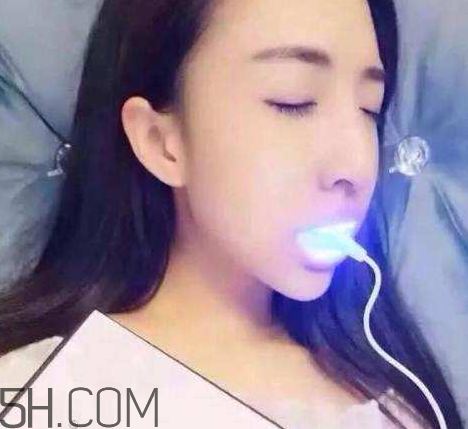 美牙儀可以兩個(gè)人用嗎？美牙儀用多久才有作用？