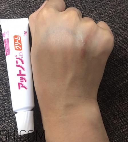 小林制藥祛疤膏有效嗎？小林制藥祛疤膏怎么樣？