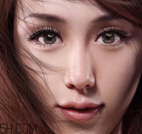 上瞼提肌手術(shù)有必要嗎？上瞼提肌后是永久的嗎？