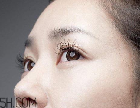 上瞼提肌手術(shù)有必要嗎？上瞼提肌后是永久的嗎？