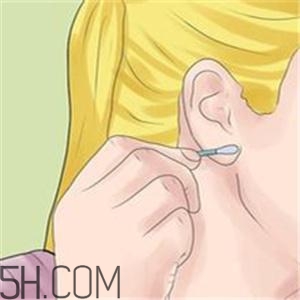 打耳洞后該如何預防感染？打耳洞前需要注意的細節？