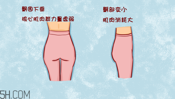 臀部護理對健康有什么影響？日常如何保養(yǎng)臀部健康？