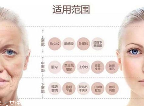 大v線會斷嗎？一定要選擇正規整形醫院