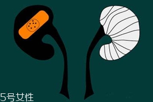 腎病為什么會發展到尿毒癥？這些因素一定要注意