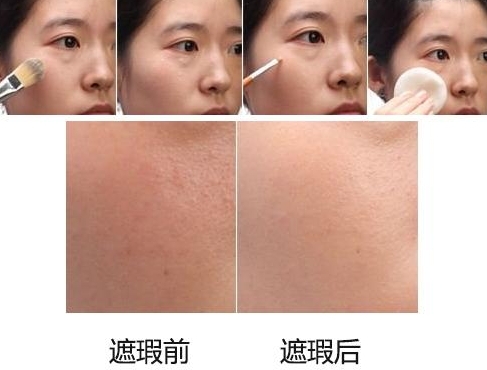 遮瑕膏可以遮痘印和痘坑嗎？推薦幾款遮瑕產品