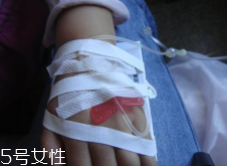 輸液治療不適合哪些??？過敏反應危害大