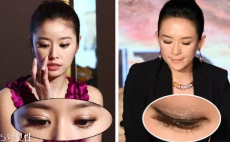 內雙怎么進化成雙眼皮？全是雙眼皮貼的功勞