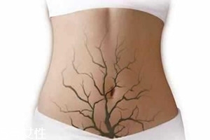 體內毒素超標有何表現？五大癥狀須注意