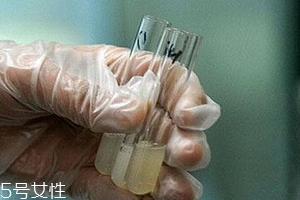 捐精有什么危害？專家稱沒有危害