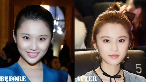 瑯琊榜2張慧雯整容了嗎？換了妝發美到不認識