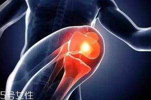 關節有響聲是病嗎？兩種情況區別對待
