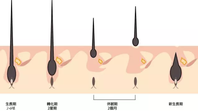 頭發為什么會掉？毛囊想休息了