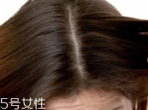 油性頭發跟什么有關？離不了這6個原因