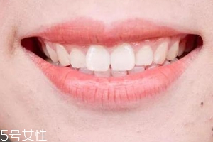 口紅病有哪些癥狀？使用不當引發癌癥