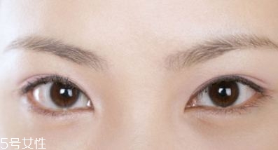 割雙眼皮失敗的常見(jiàn)原因 割雙眼皮的最佳年齡