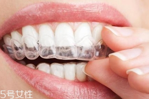 隱形牙套可以放餐巾紙上嗎？不衛生