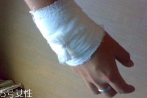 被蜈蚣咬傷后能治愈嗎？科學(xué)家有新發(fā)現(xiàn)