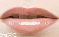 嘴唇干裂是一種病嗎？治療口角炎從改善習(xí)慣入手