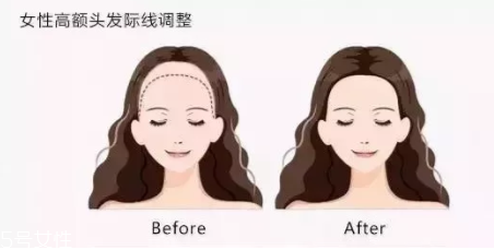 發際線粉填充和發際線筆哪個好？配合使用才最完美