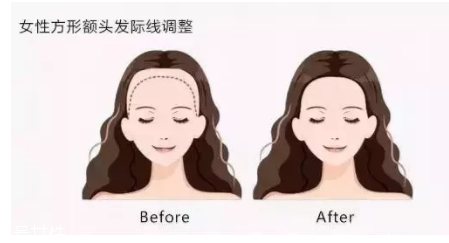 發際線粉填充和發際線筆哪個好？配合使用才最完美