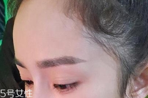 發際線高怎么治？拯救發際線攻略