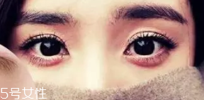 臥蠶和眼袋的區別是什么？臥蠶是肌肉眼袋是肥肉