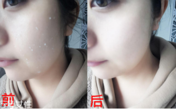 rosette去角質凝膠怎么樣？真正的去角質產品