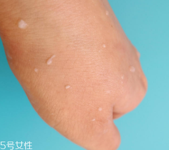 rosette去角質凝膠怎么樣？真正的去角質產品