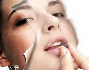 春季如何預防皮膚過敏？選擇敏感肌專用護膚品