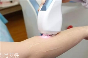 脫毛儀可以脫發(fā)際線嗎？脫了還會(huì)再長(zhǎng)