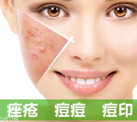 a酸怎么用？a酸怎么建立耐受？