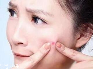 臉頰老長痘痘怎么辦 4個小技巧穩贏