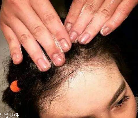 臟辮多久洗一次 臟辮是這樣養護的