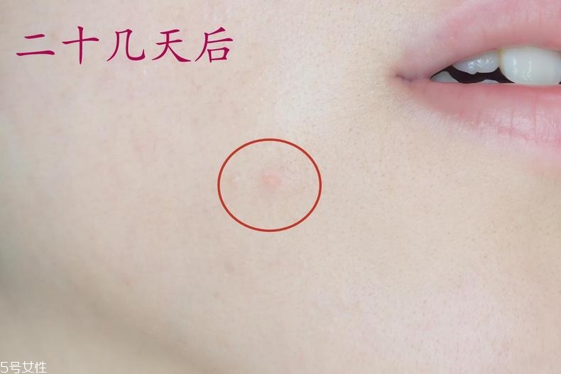 雅詩蘭黛晶透沁白防曬搖搖乳成膜快嗎？適合油痘皮嗎？
