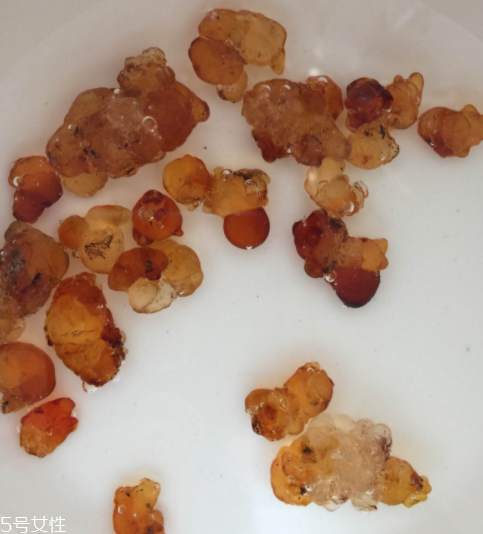 桃膠能治胃病嗎？胃病吃桃膠好嗎？