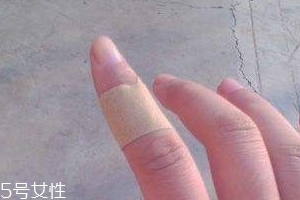 創可貼可以消腫嗎？創可貼有消腫功效嗎？