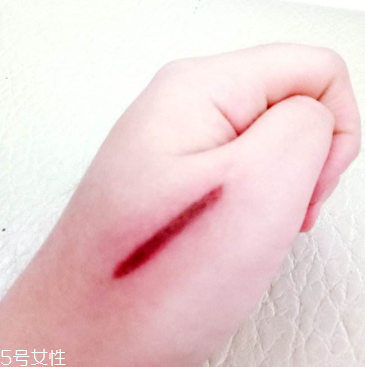 創可貼和肉連著怎么辦？創可貼連著肉怎么處理？