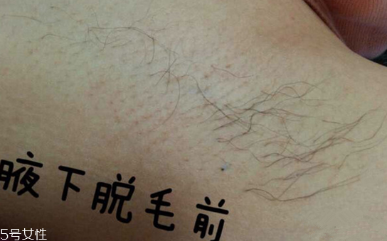 雅萌脫毛儀閃燈次數是多少 雅萌脫毛儀的使用壽命