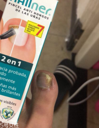 灰甲清有副作用嗎？灰甲清有哪些副作用？