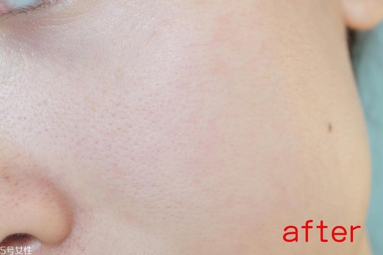 radha beauty vc精華白天能用嗎？敏感肌能用嗎？