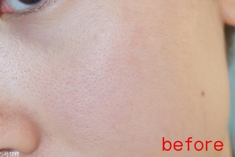 radha beauty vc精華白天能用嗎？敏感肌能用嗎？