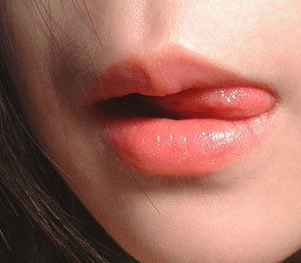 兔唇修復(fù)要多少錢？兔唇修復(fù)風(fēng)險(xiǎn)大嗎