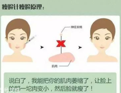 溶脂針和瘦臉針哪個貴 溶脂針和瘦臉針區別